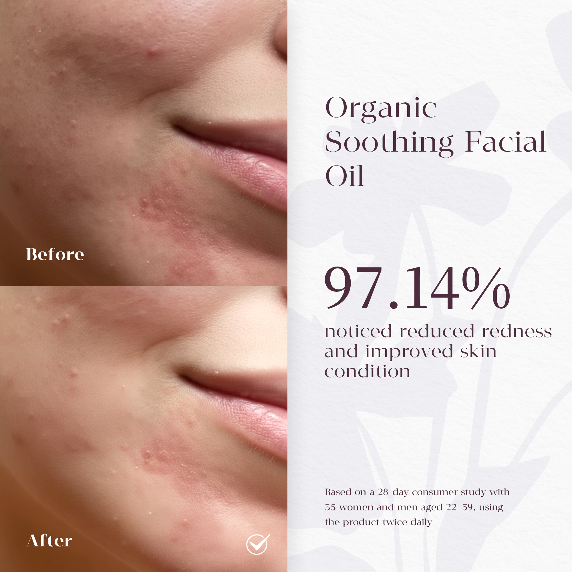 Borage Skin Rescue Jelly Elixir——Borage Skin Rescue Jelly Elixir The "Botanical Iced Tea": Cool Inflammation & Repair Barrier Instantly.