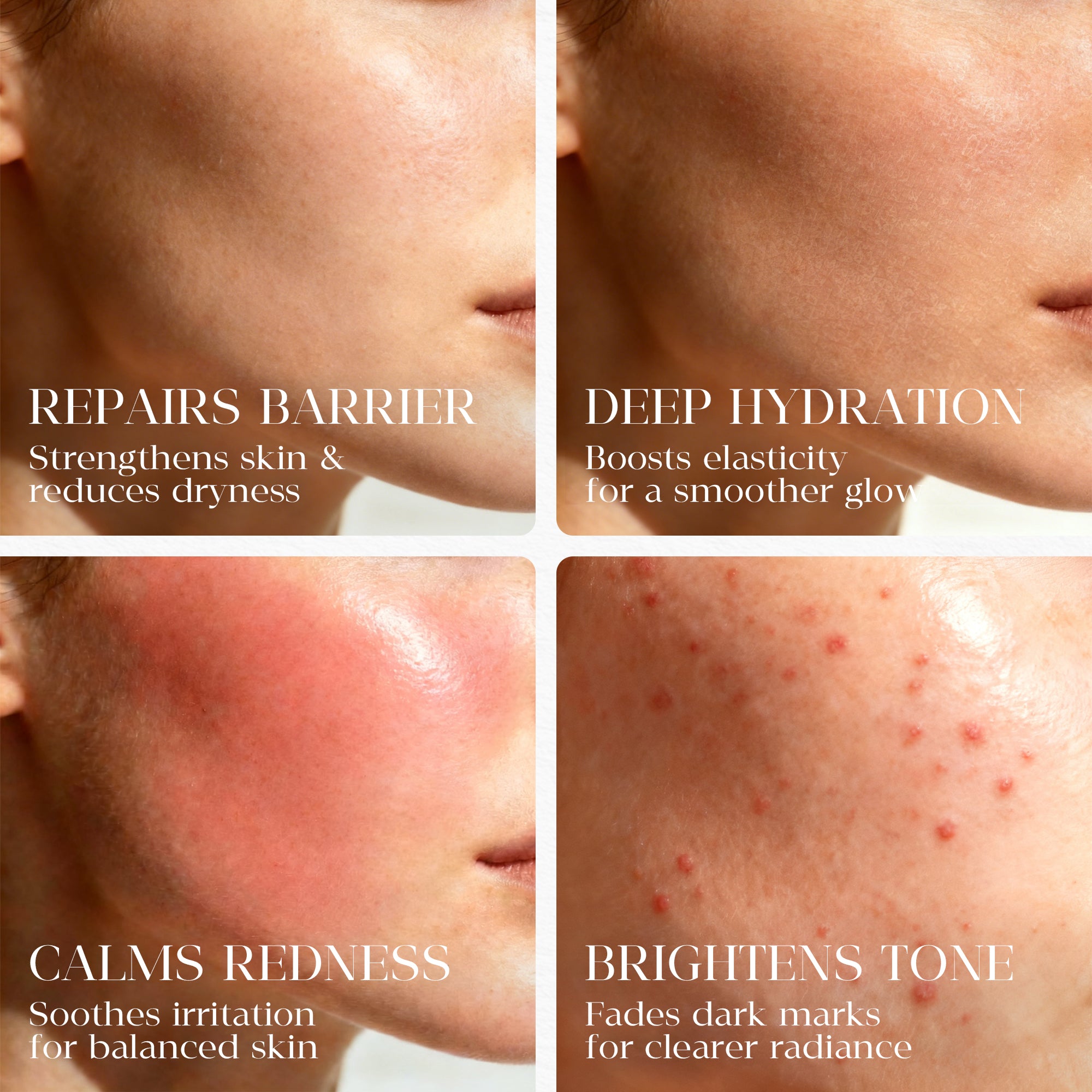 Borage Skin Rescue Oil—— The "Liquid Bandage": Restore Your Barrier & Soothe Redness Instantly.