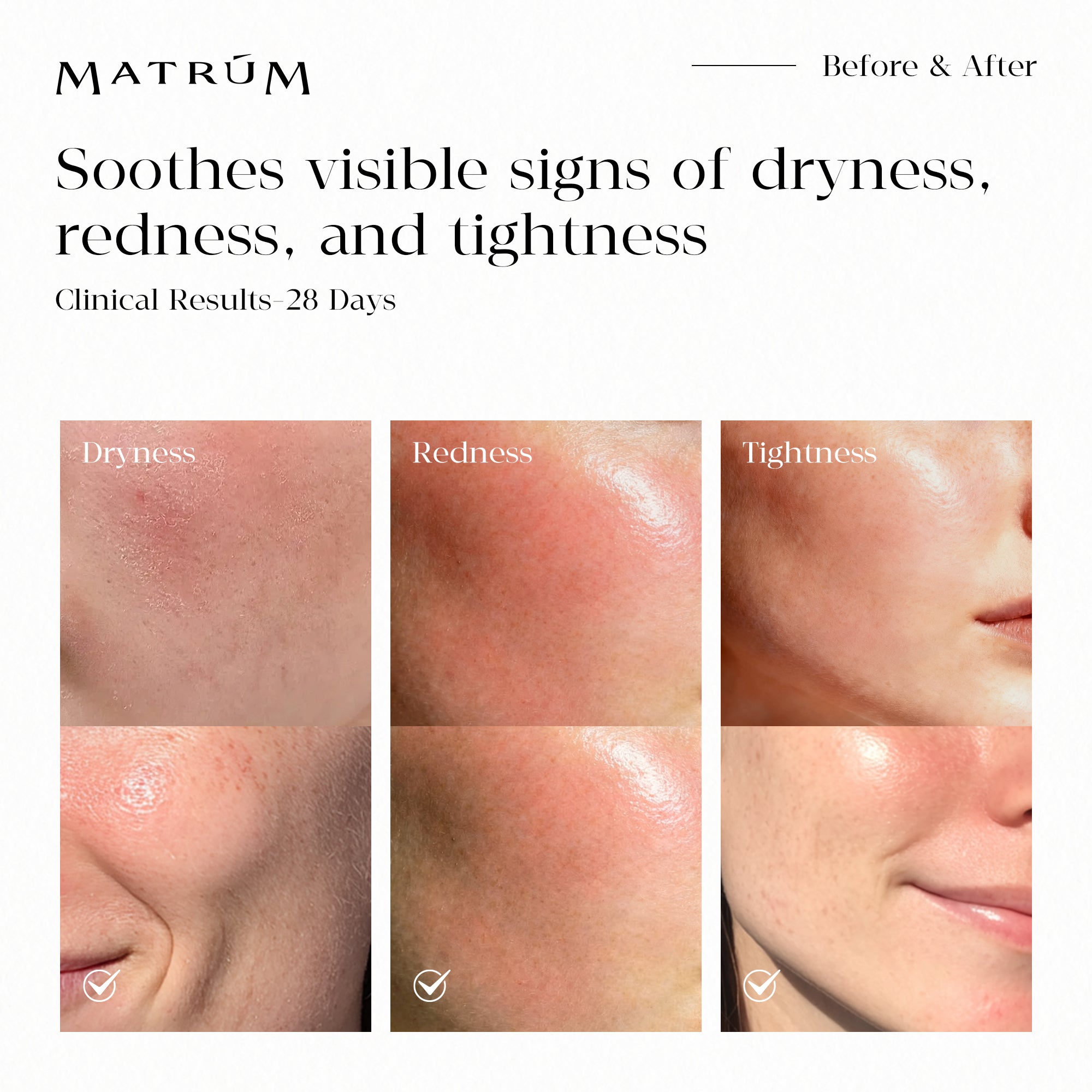 MATRÚM Mini Face Oil Discovery Set（4 × 5ml）